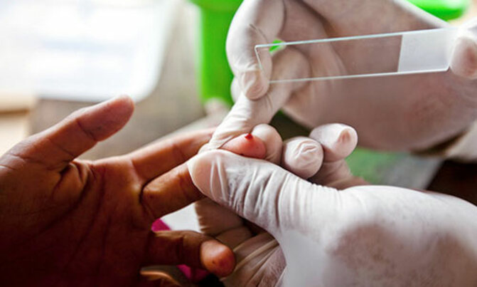 Scientists find rare group of children who are naturally immune to malaria Scientists find rare group of children who are naturally immune to malaria
