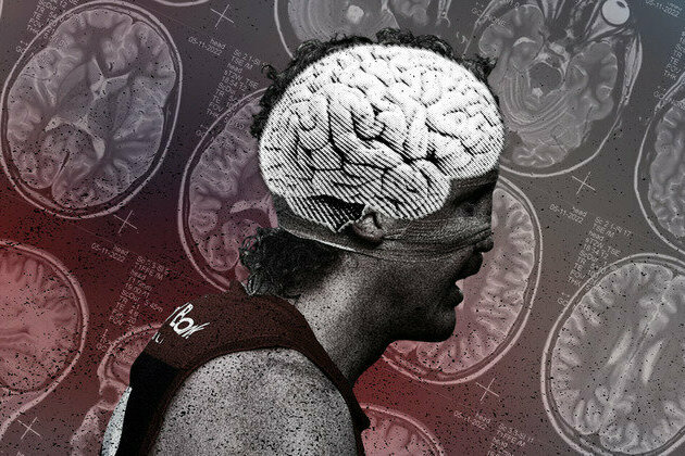 I've seen the brain damage contact sports can cause - we all need to take concussion and CTE more seriously