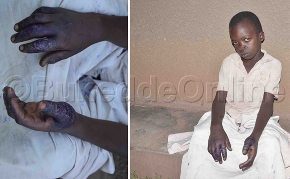 Herbert Muyanja eyayokeddwa Herbert Muyanja eyayokeddwa