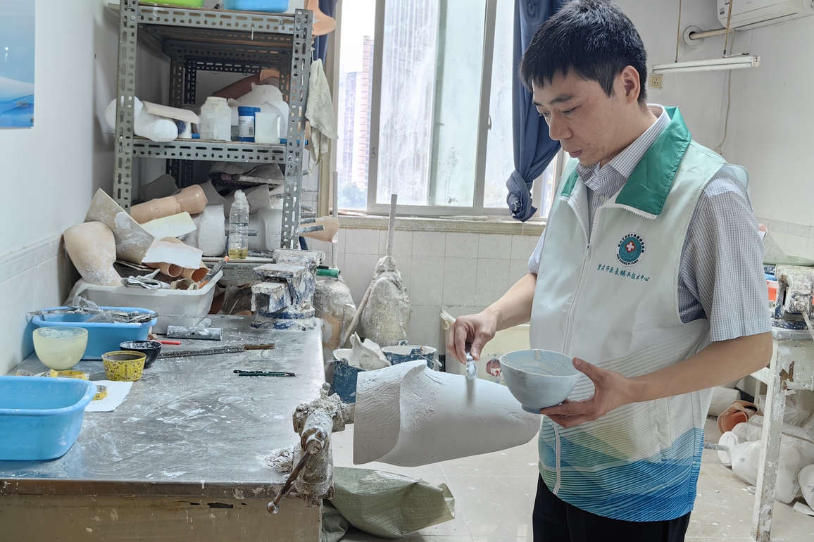 CHINA-CHONGQING-HOSPITAL-PROSTHETISTS (CN)
