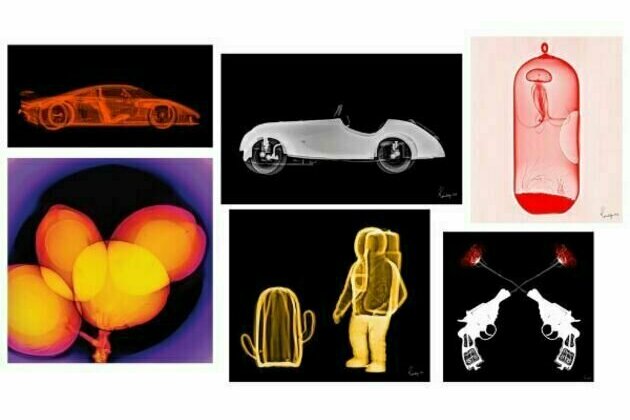 Karmaditya Baldota's X-ray art exhibition is on show at Nehru Art Center Gallery