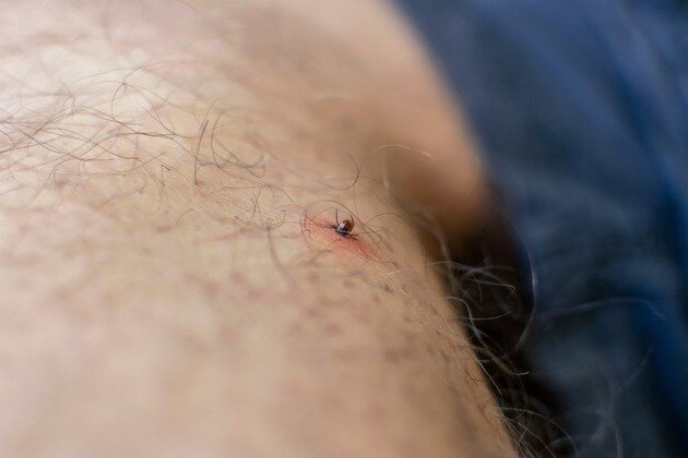 Amid summer surge, Wisconsin scientists need tick samples