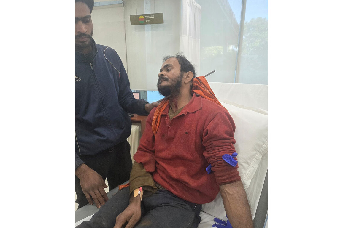 Steel rod through skull: How Gurugram doctors saved a man after an unsurvivable accident,