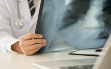 Pulse Insurance extends Reframe Cancer offering