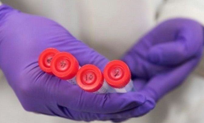 At-home test could boost screening for cervical cancer At-home test could boost screening for cervical cancer