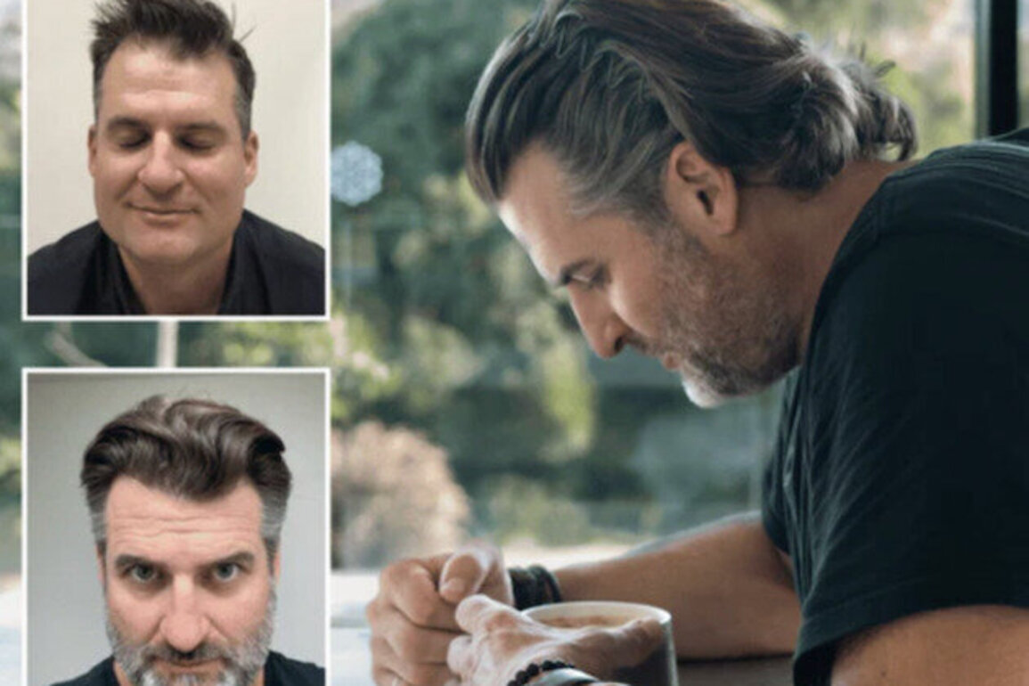 What to look for when choosing a hair restoration clinic in Australia