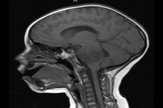 Researchers develop cheaper method to identify aggressive tumours
