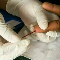 US approves twice-yearly injection for HIV prevention - what you need to know about lenacapavir