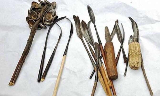 FGM surgeons surrender tools. FGM surgeons surrender tools.