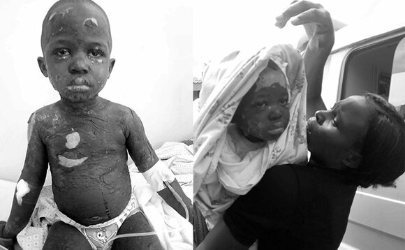 Faith Nyachwo maama wa Elijah Musasizi ng'amusitudde mu ddwaaliro e Kiruddu. Faith Nyachwo maama wa Elijah Musasizi ng'amusitudde mu ddwaaliro e Kiruddu.