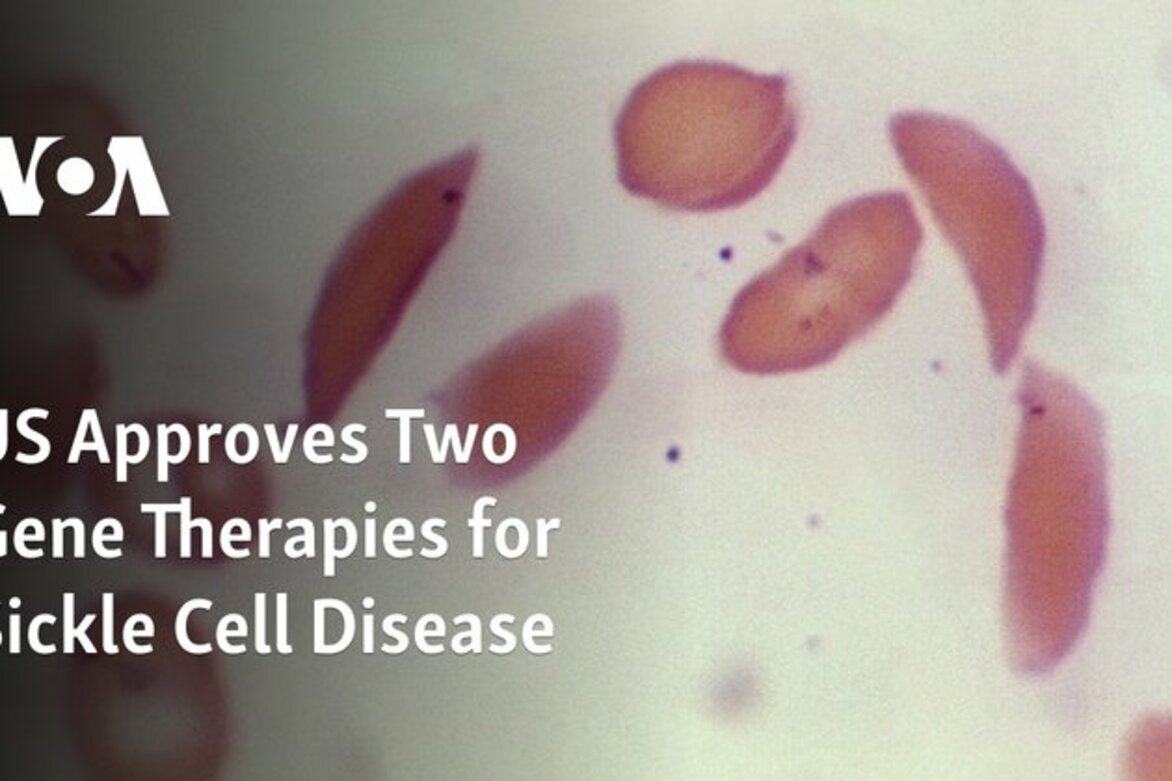 US Approves Two Gene Therapies for Sickle Cell Disease