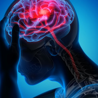 World Stroke Day: Experts raise concern over brain strokes among young adults under 45