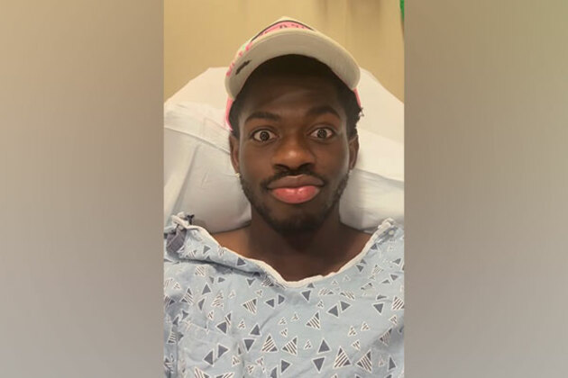 Lil Nas X hospitalized after he 'lost control' of the right side of his face