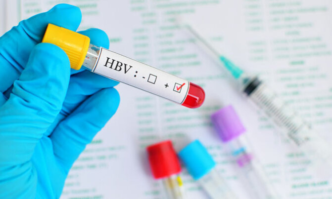 Hepatitis B affects 3.5 million Ugandans Hepatitis B affects 3.5 million Ugandans