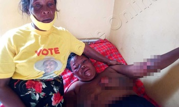 Mukwano gwa Namyalo ng'amujjanjaba mu ddwaaliro. Namyalo aliko ebiwundu mu kifuba ne ku mukono era azimbye ne mu maaso. Mukwano gwa Namyalo ng'amujjanjaba mu ddwaaliro. Namyalo aliko ebiwundu mu kifuba ne ku mukono era azimbye ne mu maaso.