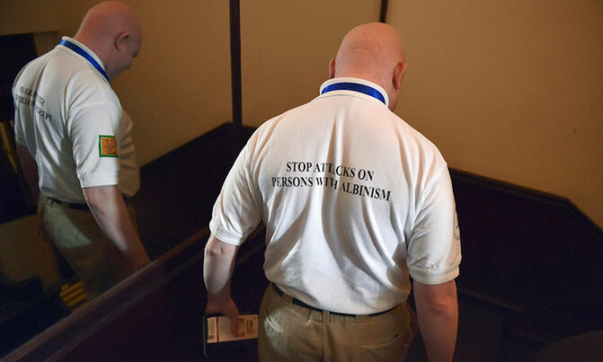 Malawi court sentences three to death over albino killing Malawi court sentences three to death over albino killing