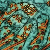 Heeding the lessons of COVID-19 in the face of avian influenza