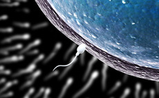 Axcel acquires European Sperm Bank