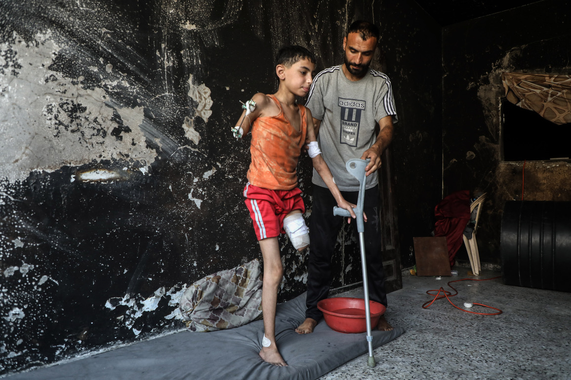 MIDEAST-GAZA CITY-DISABILITY