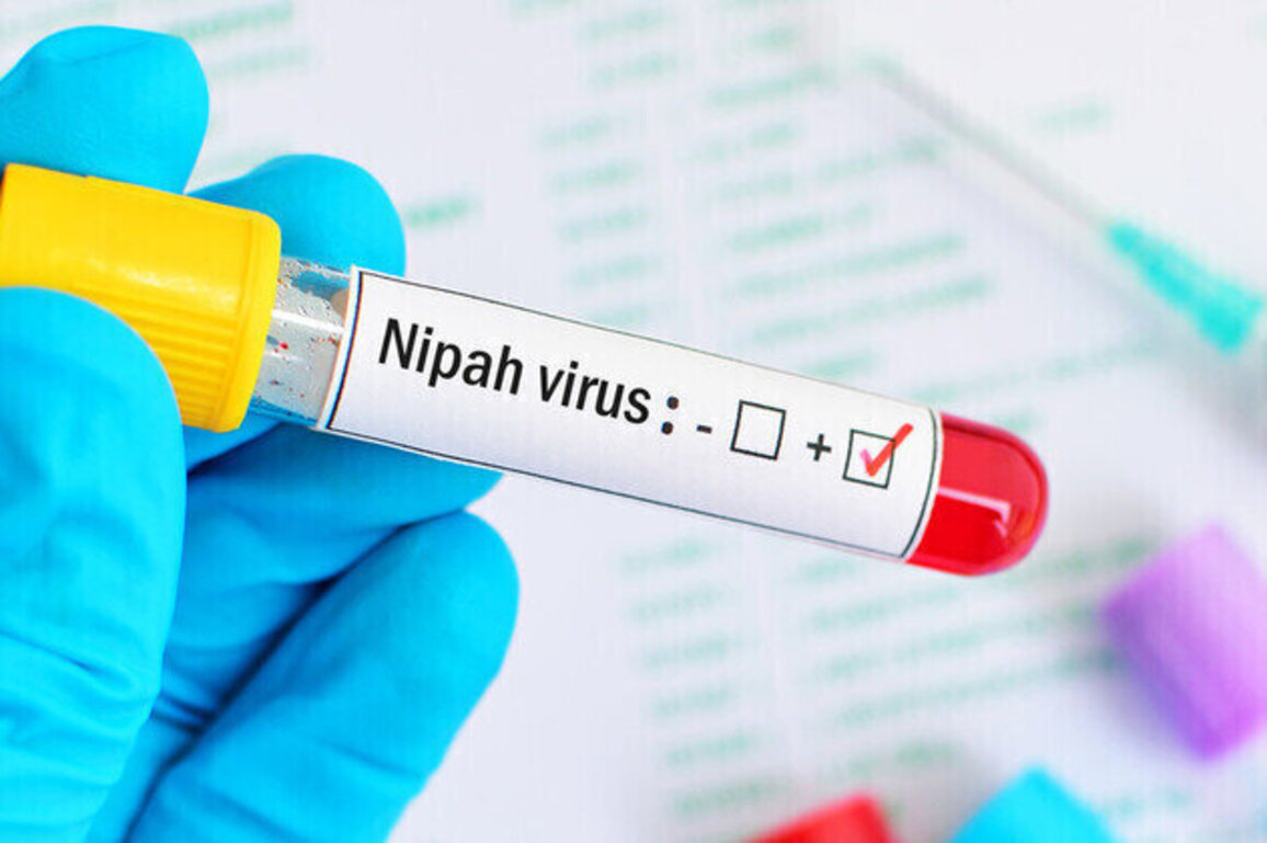 No need for panic over Nipah virus  Indian doctor