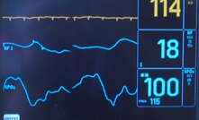 Triton probed by ASX