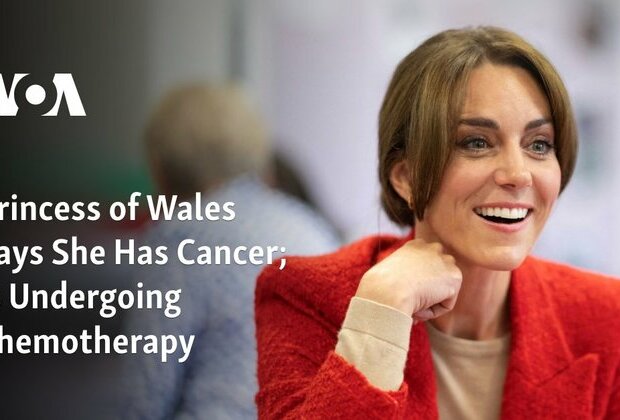 Princess of Wales Says She Has Cancer; Is Undergoing Chemotherapy