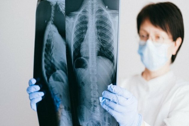 Human T cells play key role in controlling respiratory syncytial virus infection: Research