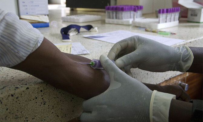 Should students' HIV status be disclosed? Should students' HIV status be disclosed?