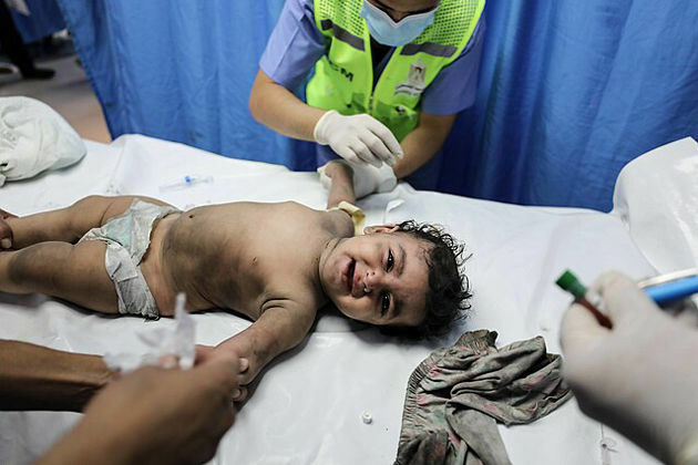Doctors warn that baby formula in Gaza is critically low