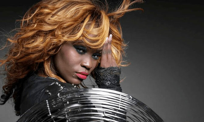 Jackie Chandiru in bad shape at Mulago Jackie Chandiru in bad shape at Mulago