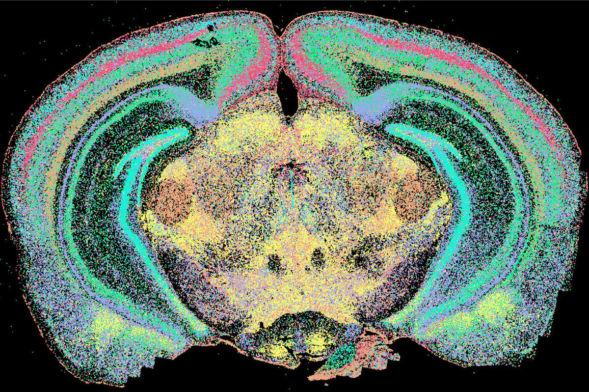 $12 million grant funds studies of role of genes in autism, similar diagnoses - The Source - WashU
