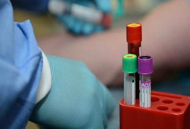 Rapid blood test could detect brain injury in minutes, study shows