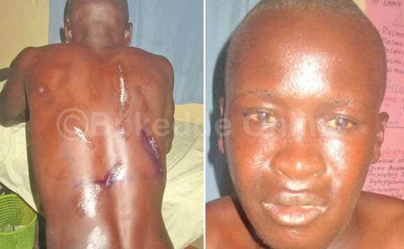 Mutabaazi ng’alaga ebiwundu bye yafunye ku mugongo. Ku ddyo bw’afaanana. Mutabaazi ng’alaga ebiwundu bye yafunye ku mugongo. Ku ddyo bw’afaanana.
