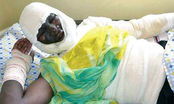 Kiyemba apooca mu ddwaaliro e Kiruddu. Kiyemba apooca mu ddwaaliro e Kiruddu.