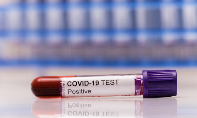 Uganda registers second COVID-19 death Uganda registers second COVID-19 death