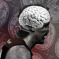I've seen the brain damage contact sports can cause - we all need to take concussion and CTE more seriously