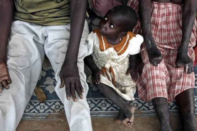 South Sudan Leprosy Camp Finally Gets Aid