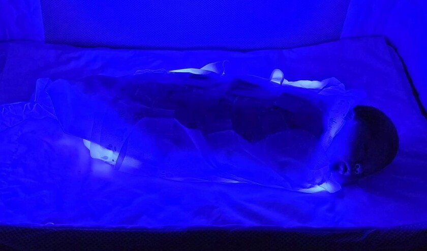 The Neonatal Hospital at Home service © Royal Hospital for Children