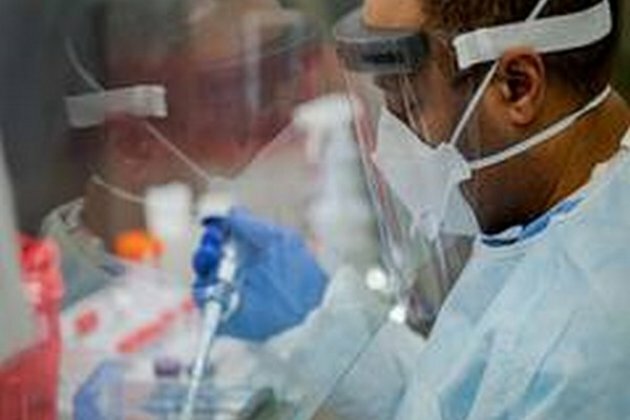 COVID-19 cases in Brazil rises by 55,155 to over 3.16 million