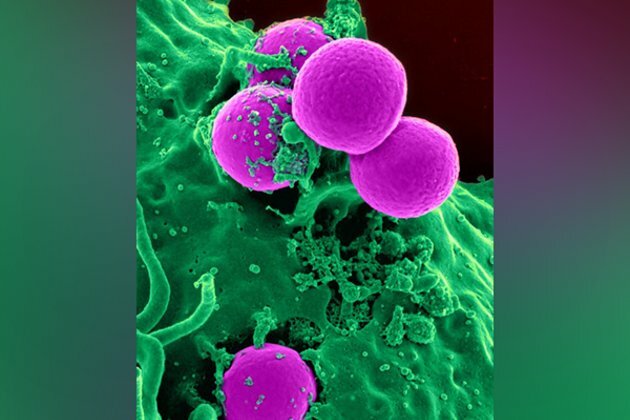 Study sheds light on blood cells' precancerous 'clonal expansion'