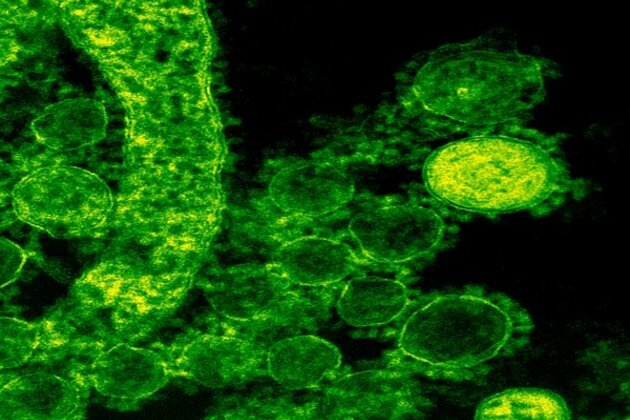 Study finds how highly resistant strains of fungi emerge