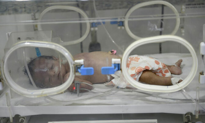 Gut feeling: How C-sections change a baby's gut ecosystem Gut feeling: How C-sections change a baby's gut ecosystem