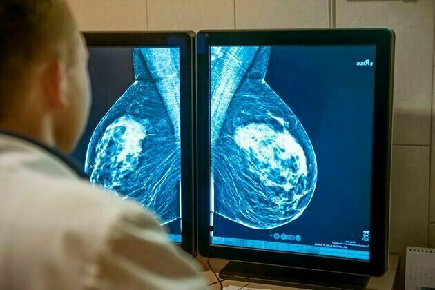 Australian women are wary of AI being used in breast cancer screening - new research
