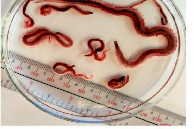 New species of soil-cleaning worm named after Iloilo