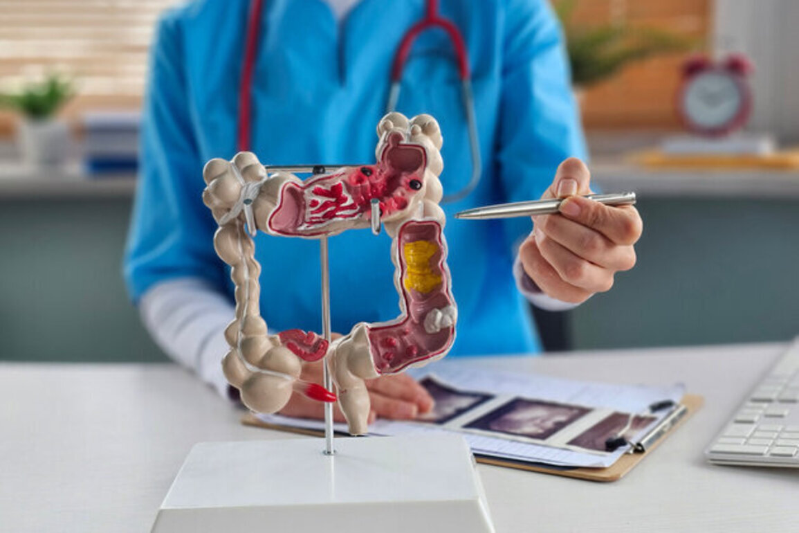 Early screenings for colorectal cancer can save TN lives