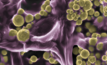 A coloured SEM image of the gold-coated fusarium oxysporum fungi