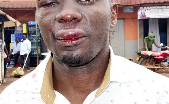 Lumu eyakubiddwa. Lumu eyakubiddwa.