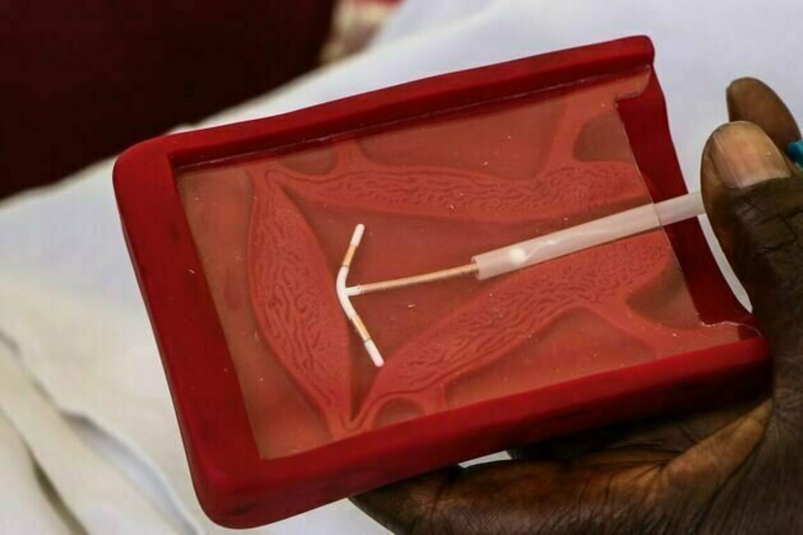 Birth control in Africa: study tracks the use of long-acting contraception in 26 countries