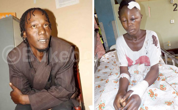 Edward Kyakuwa eyafumise muganda we ebiso n'amutta ate ku ddyo ye mukazi we Achan ng’apooca n’ebisago ku kitanda e Mulago. Edward Kyakuwa eyafumise muganda we ebiso n'amutta ate ku ddyo ye mukazi we Achan ng’apooca n’ebisago ku kitanda e Mulago.