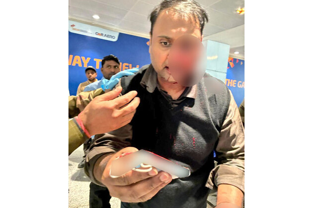 "It happened just too fast... I don't know when I landed on floor": Ankit Dewan on alleged assault